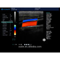 Portable ultrasound color doppler laptop 4d doppler ultrasound